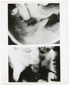 1970s Gelatin Photo X Ray Stills DENNIS OPPENHEIM