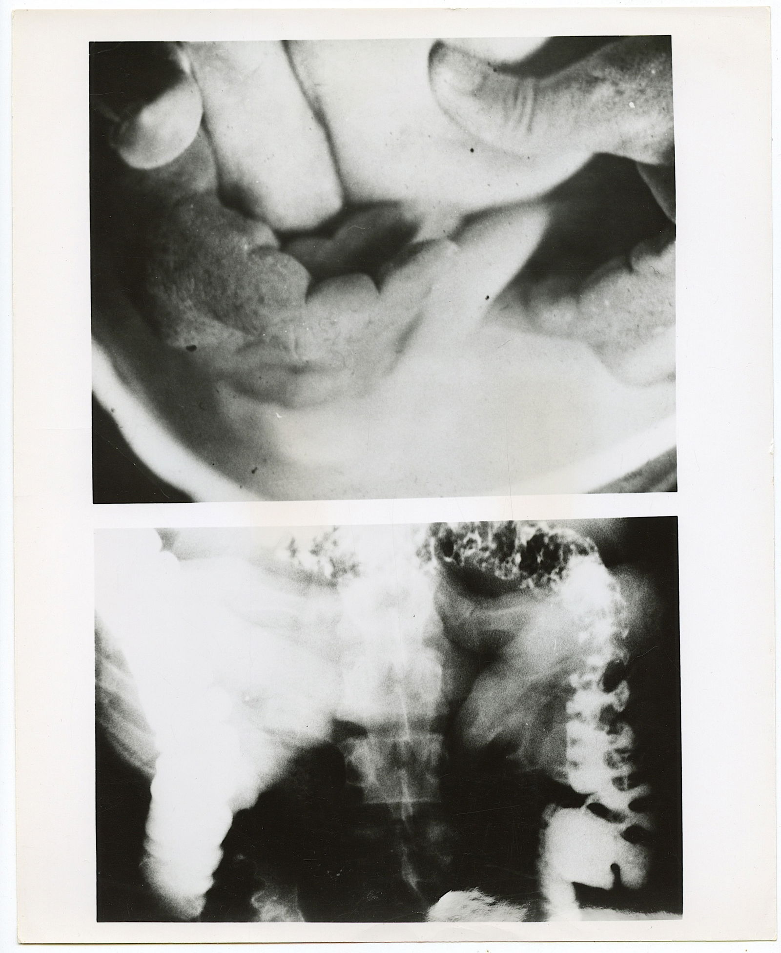 1970s Gelatin Photo X Ray Stills DENNIS OPPENHEIM: The provenance of this lot is from the estate of a deceased formal art collector in Miami, FL. The dimensions are Approx. 10" x 8". Please see all the included images to read all related information a
