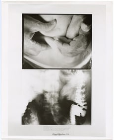 1970 Art Photo DENNIS OPPENHEIM Still From Stomach