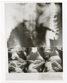 1970 Art Photo DENNIS OPPENHEIM Still From Stomach