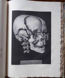 J. B. M. BOURGERY Traite de l'anatomie- 1st Ed. Vol-1: FOR SALE THE VOLUME 1 (PLANCHE 1 TO PLANCHE 59), 1ST EDITION - JEAN BAPTISTE MARC BOURGERY (1797Â1849) AND NICOLAS HENRI JACOB (1781Â1871, ILLUSTRATOR)Traité complet de l'anatomie de l'homme,