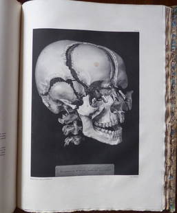 J. B. M. BOURGERY Traite de l'anatomie- 1st Ed. Vol-1: FOR SALE THE VOLUME 1 (PLANCHE 1 TO PLANCHE 59), 1ST EDITION - JEAN BAPTISTE MARC BOURGERY (1797Â­1849) AND NICOLAS HENRI JACOB (1781Â­1871, ILLUSTRATOR)TraitÃ© complet de l'anatomie de l'homme,