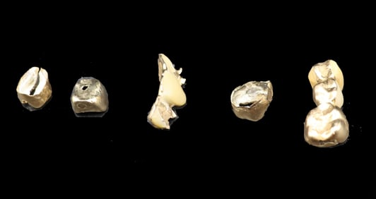 (5) 14K Gold Teeth - Gross 21.1 g.