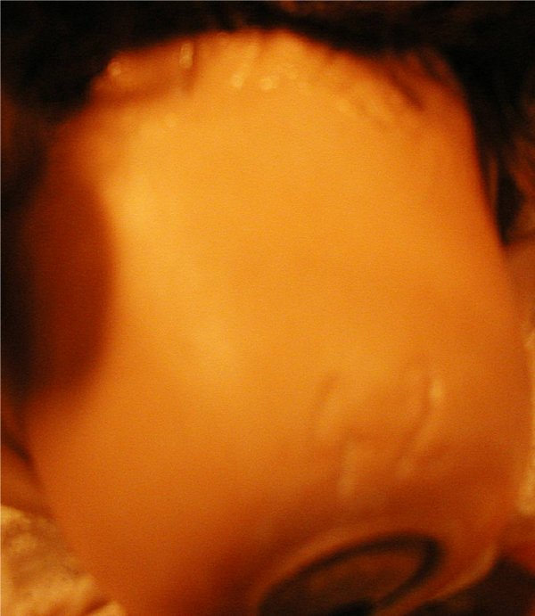 Kestner, JD Mold #122 Ca. 1912 Doll - 3
