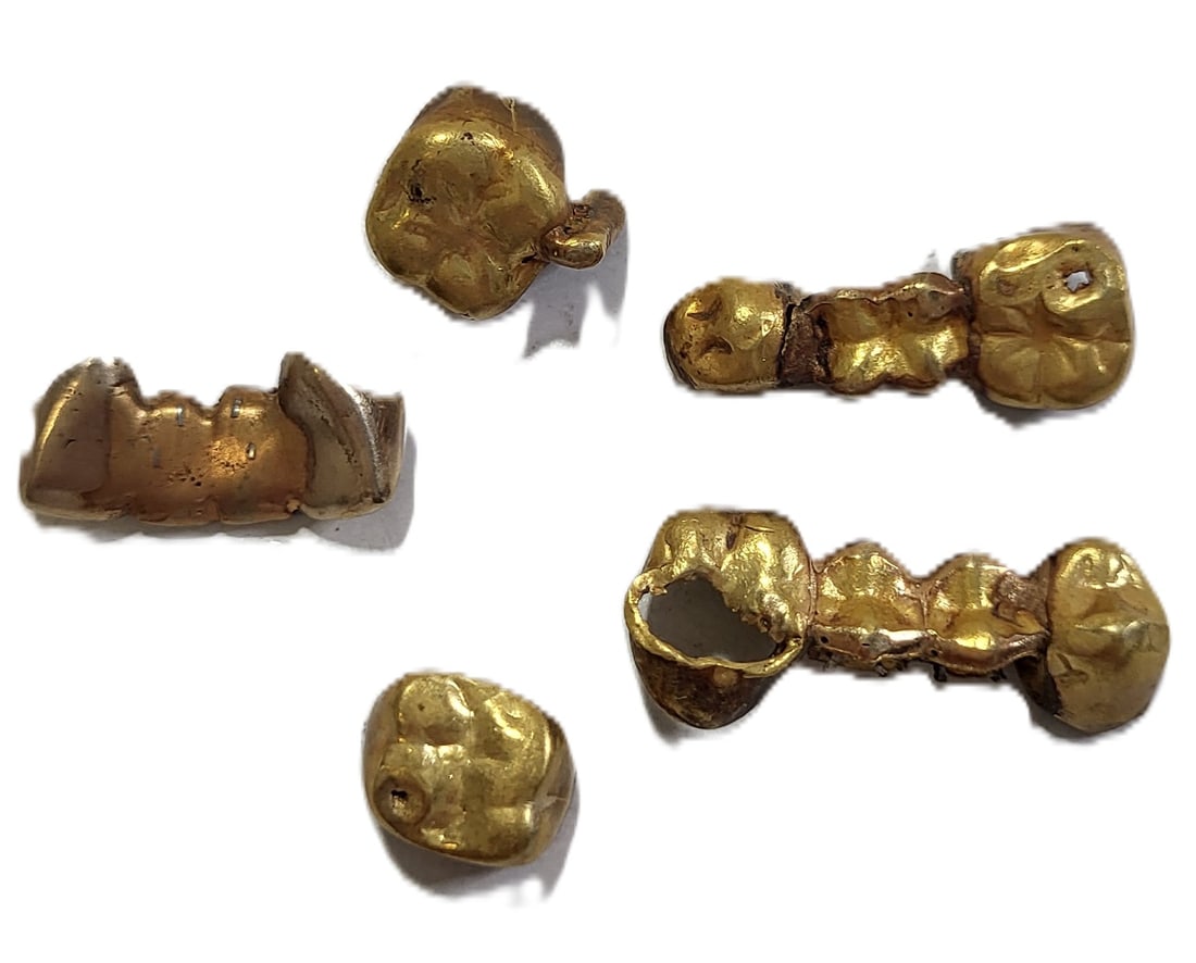 Lot Dental Gold Aprox 9.8dwt 15.2g Total Items Weight: Lot Dental Gold Aprox 9.8dwt 15.2g Total Items Weight. Note as some of the crowns have inclusions the total gold weight will be less than the aforementioned amounts. Karat purities are unknown and may