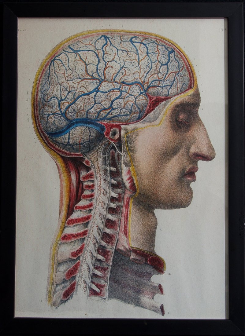 Vintage Medical Text "Brain" Illustration with Frame (1 of 1)
