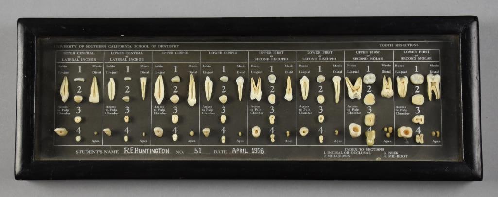 1958 Dental Student Chart USC School of Dentistry: Very interesting poster for the University of Southern California School of Dentistry. This chart belonged to student R.E. Huntington from April of 1958. These teeth dissections appear to be real
