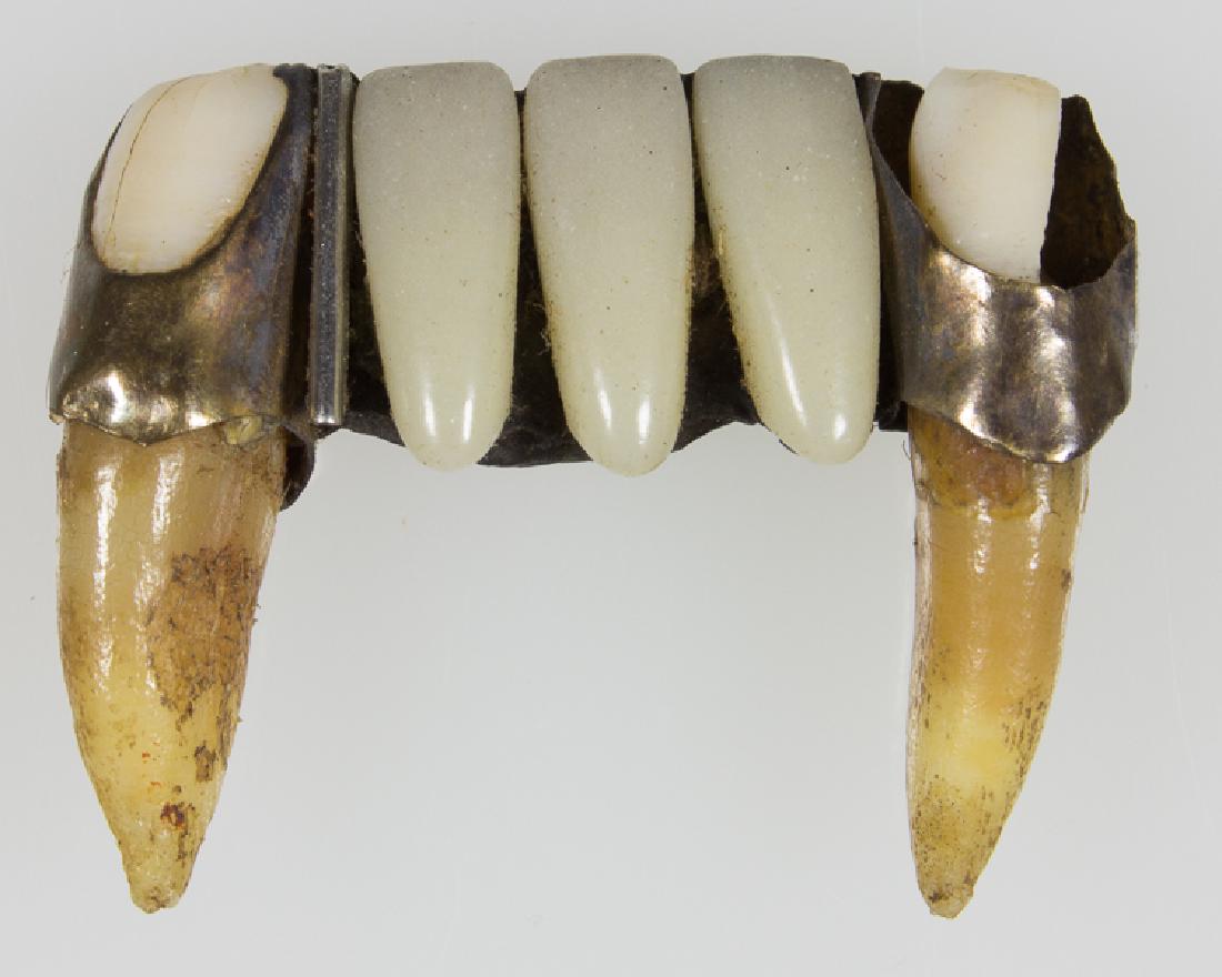 DENTAL BRIDGE FROM A JAPANESE SOLDIER K.I.A. AT IWO: DENTAL BRIDGE FROM A JAPANESE SOLDIER K.I.A. AT IWO JIMA A particularly gruesome souvenir of World War II, a partial dental bridge, approx. 1" square, consisting of three glass artificial teeth, faste