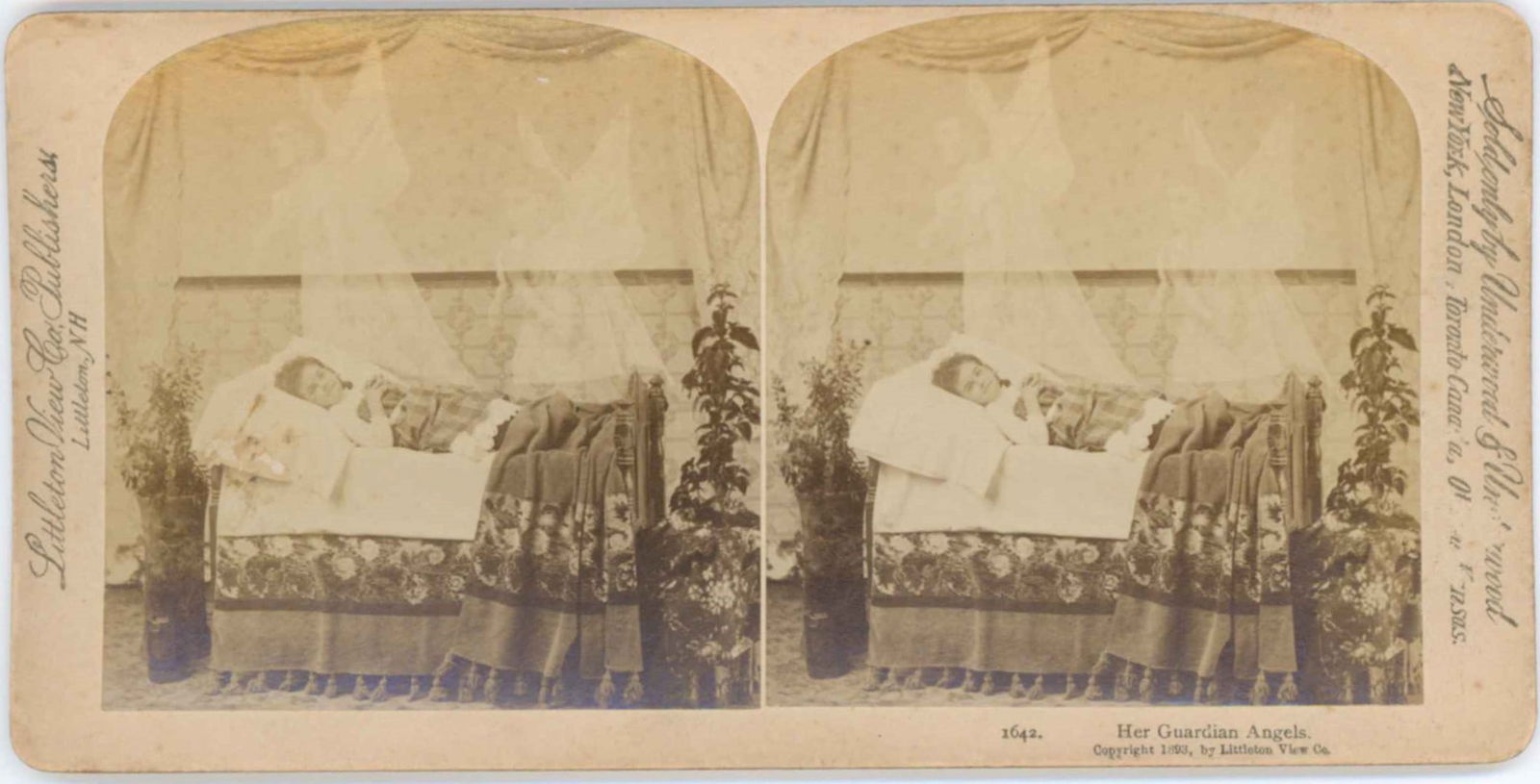 POST MORTEM STEREOVIEW OF A GIRL (1 of 1)