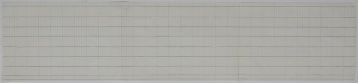 JACK RUBY’S POLYGRAPH RESULTS