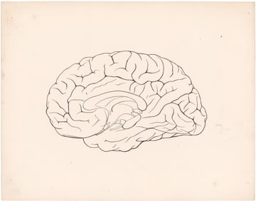 LEON CZOLGOSZ AUTOPSY SKETCH