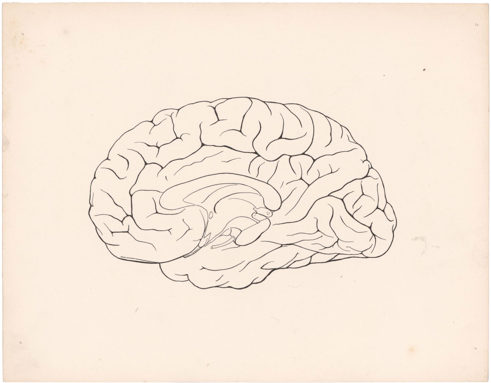 LEON CZOLGOSZ AUTOPSY SKETCH (1 of 6)