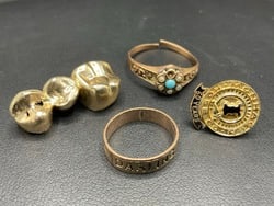 Compiled Scrap Gold Jewelry Group: Compiled Scrap Gold Jewelry Group. Dental, two rings and pin. Total weight: 9.68 grams 10K 1.48 grams9-10k 2.49 grams.Dental 5.71 grams.