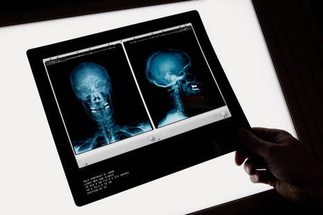 Damien Hirst X-Ray: Radiography, X-ray - published on the ocassion of exhibition Gagosian Gallery - 2010, size: 25'5 x 21'5 cm.