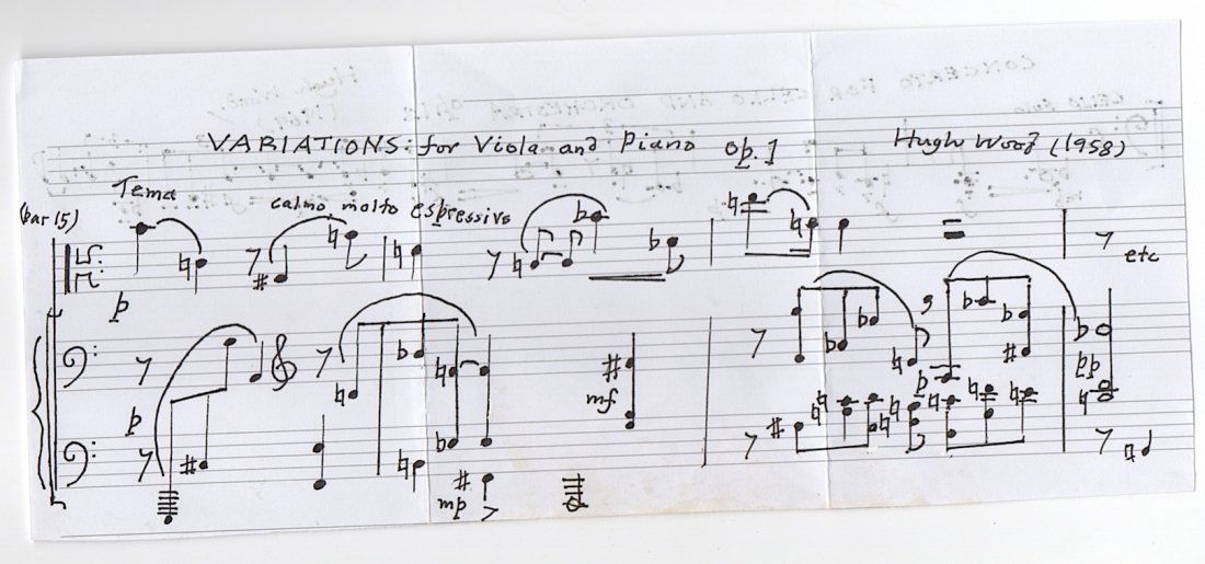 Hugh Wood (1932 - ) British composer (1 of 2)