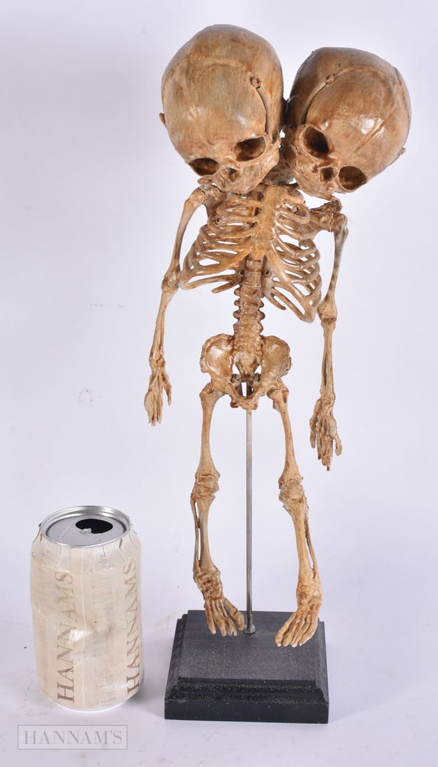 AN UNUSUAL NATURAL HISTORY DOUBLE SKELETON SKULL FIGURE. 38 cm high. (1 of 6)
