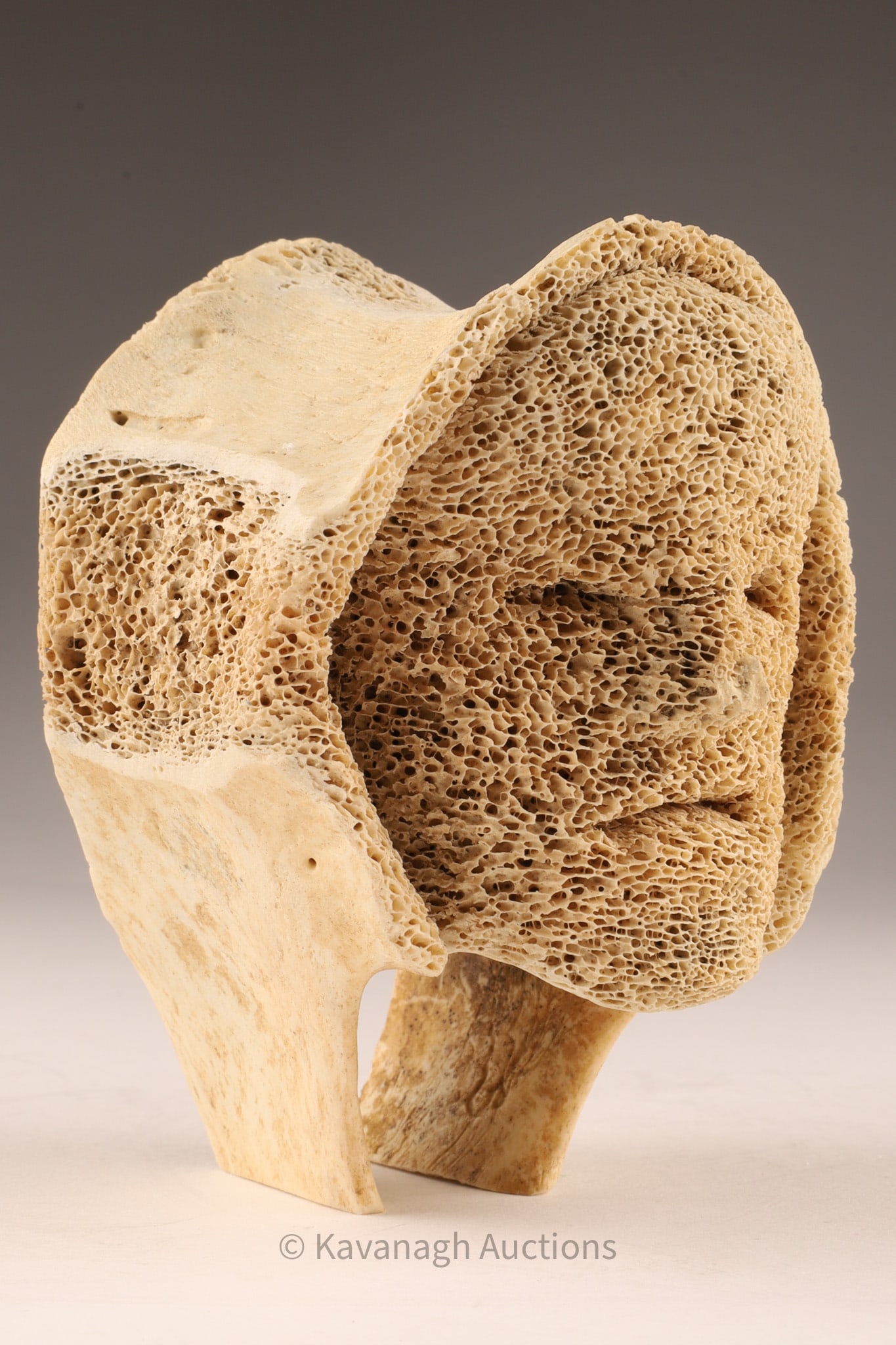 Inuit Carved Vertebra Mask, Canada, Mid-20th Century: An evocative Inuit carving, fashioned from vertebra bone, rendered into a serene human mask with closed eyes and subtle features. The porous bone surface lends an organic texture, enhancing the medita