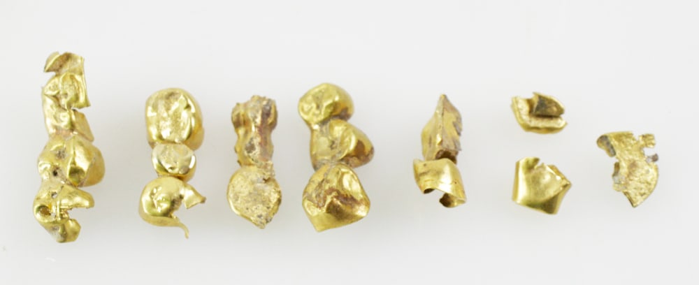 22k Dental Gold (1 of 5)