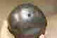 item-137098551=5