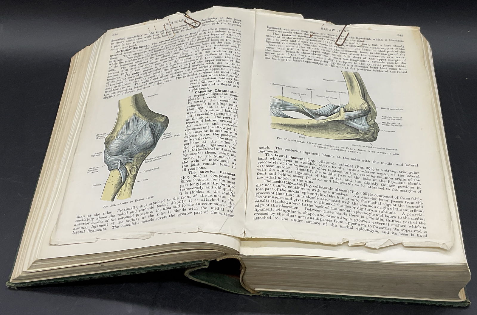 1937 CUNNINGHAMS TEXTBOOK OF ANATOMY Illustr (1 of 9)