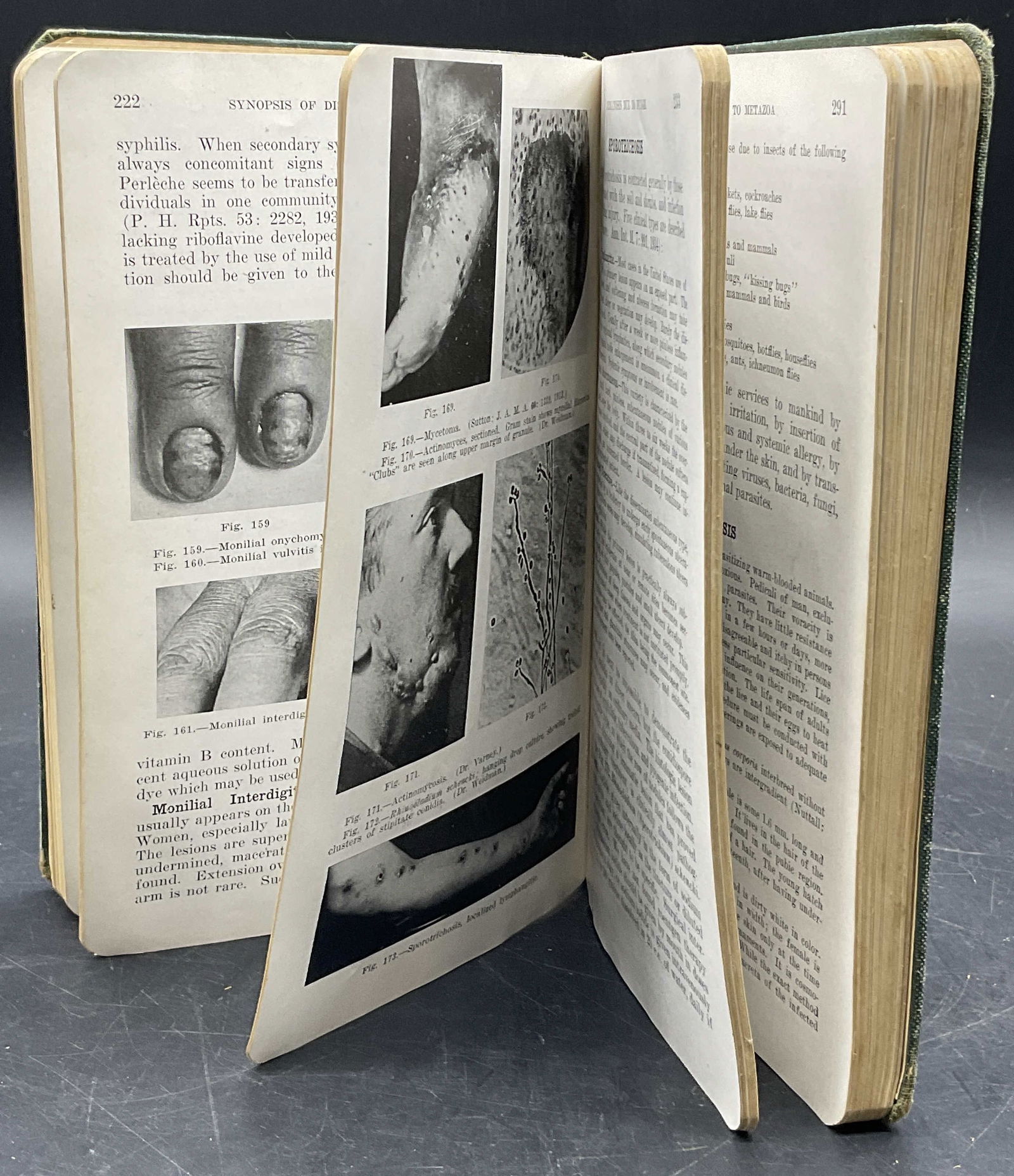 1942 Synopsis Of Diseases Of The Skin Illustr Book (1 of 8)