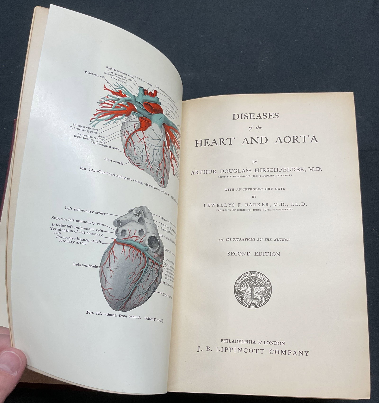 Antq 1913 Diseases Heart & Aorta, Illustrated: Antique hardcover copy of Diseases of the Heart and Aorta by Arthur Douglas Hirschfelder. 344 illustrations by the author. Published by J. B. Lippincott Company, 1913. Second edition. Measures approx.