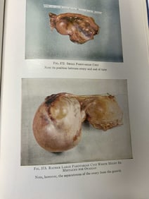 1948 Vntg book Gynecology 3rdEd EMIL NOVAK Illustr
