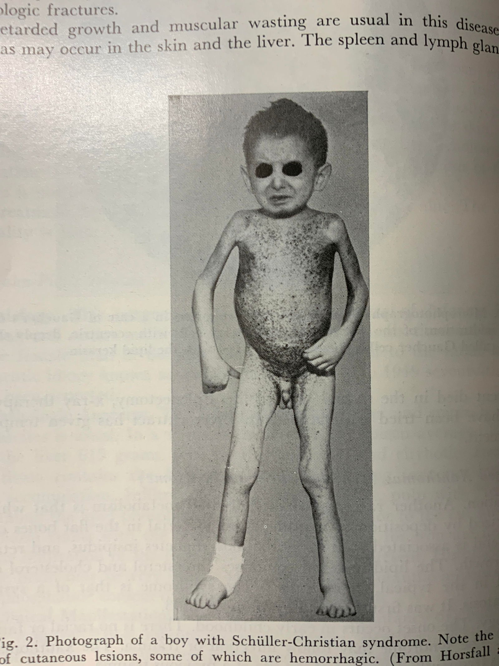 1952 Diseases of Metabolism Illustr Book DUNCAN (1 of 12)