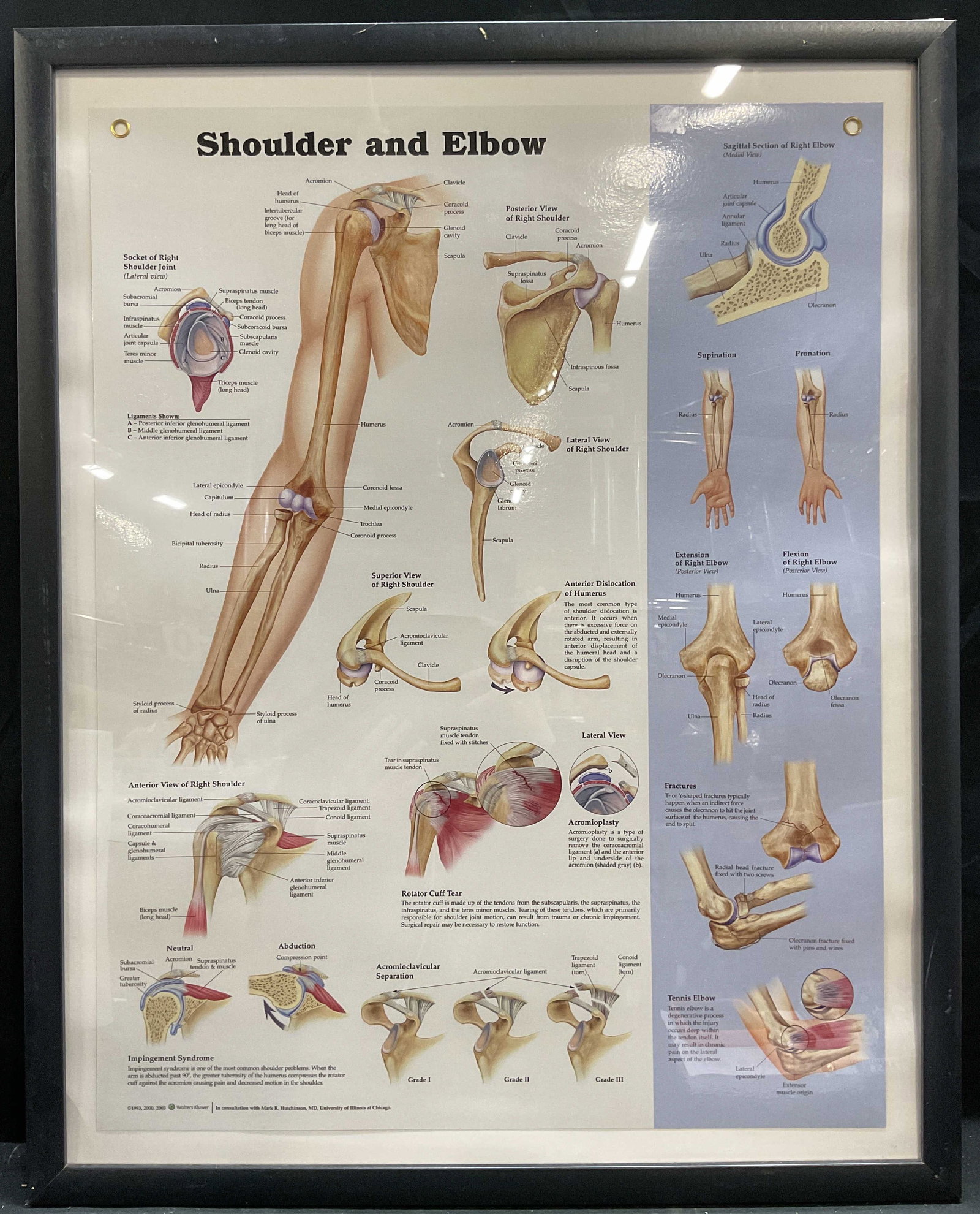 Wolters Kluwer Medical Diagram 2003 29.5in: Framed Wolters Kluwer medical diagram. Shoulder & Elbow. Black frame. Copyright 2003. Frame measures approx 29.5 x 23.5 inches. Some wear consistent with exposure. Medical diagram, shoulder, elbow, me
