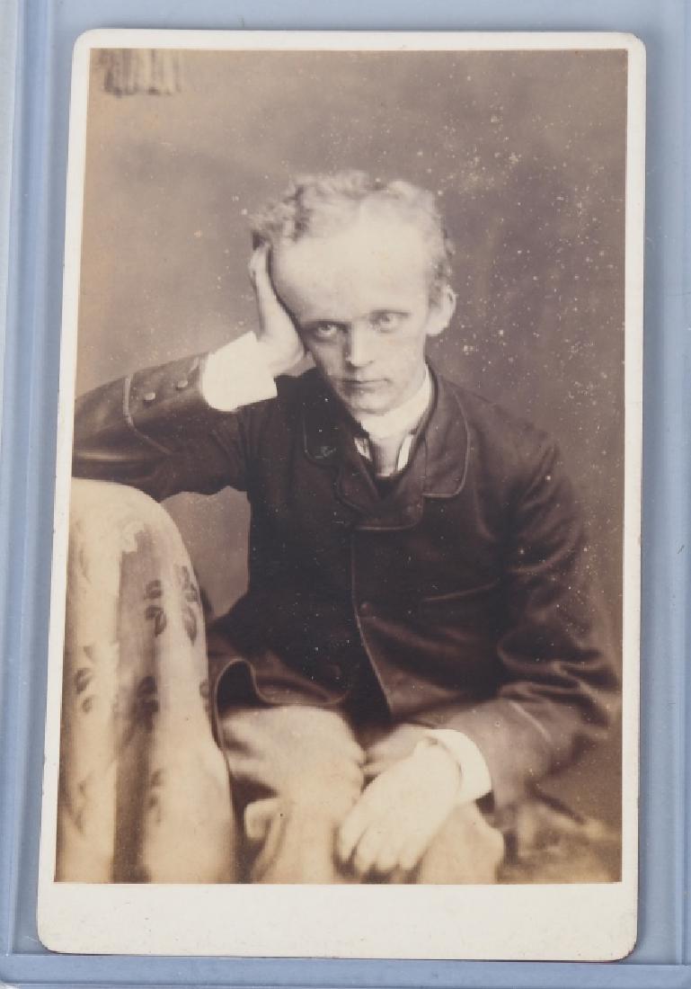 OVERSIZED HEAD HUMAN ODDITY FREAK CDV IMAGE: Original Oversized Head Human Oddity CDV Photo. By Thomas Heaward Stockport. Excellent