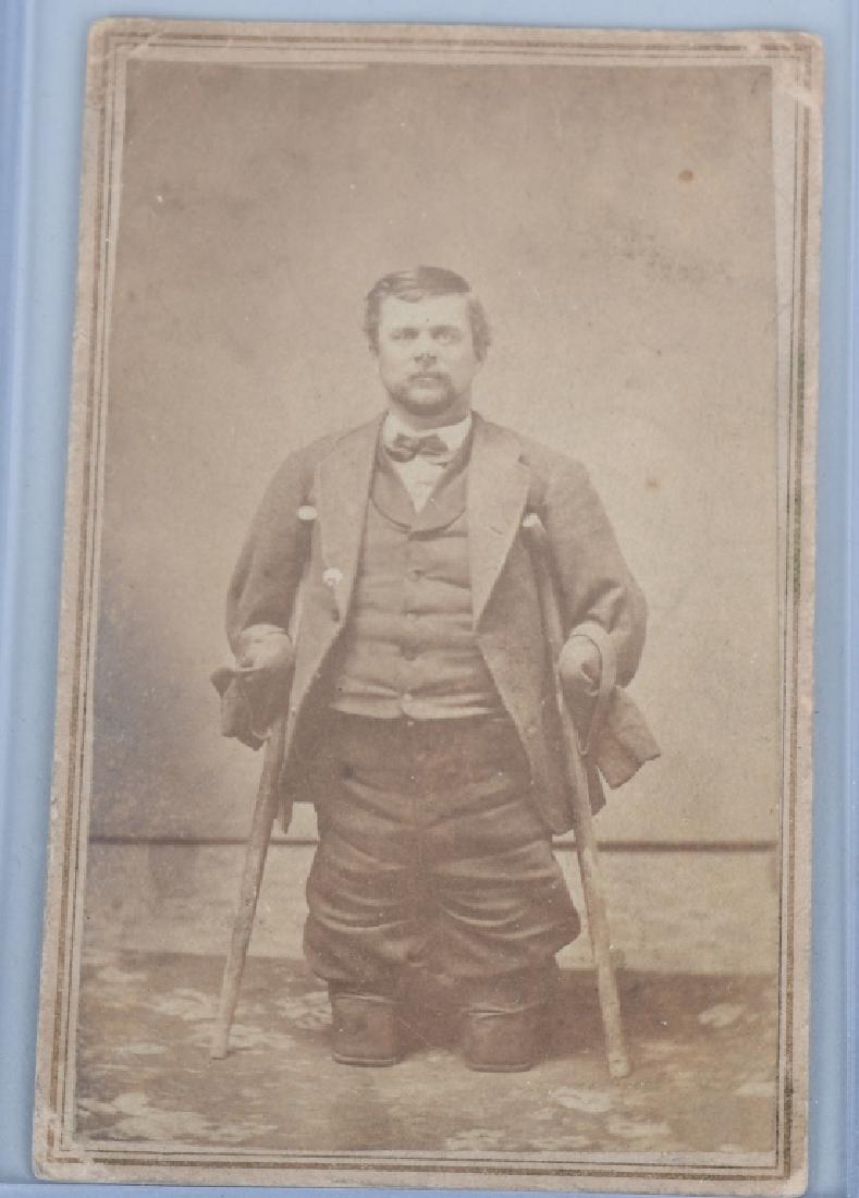 CIVIL WAR CDV BENJAMIN FRANKLIN 2nd MINN. CAVALRY: The CDV shows double amputee Benjamin Franklin of the 2nd Minn. Cavalry after he sustained frostbite injuries while traveling from Fort Wadsworth to Fort Ridley. He lost his hands and feet while his 4