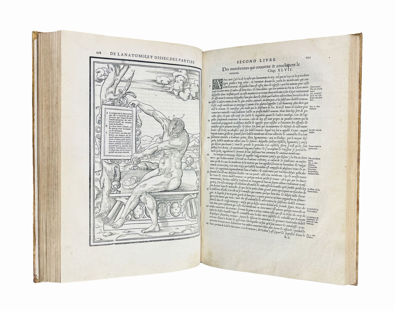 Anatomy. ESTIENNE. La dissection des parties du corps humain. (1 of 4)