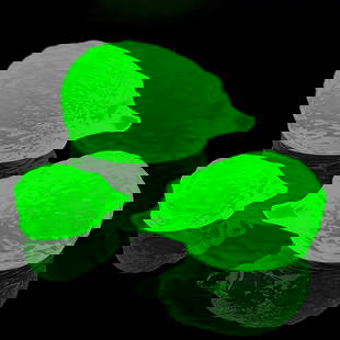 Transparent Uranium Glass Set ' The hedgehog family ' Yellow Vaseline Uranium Glass 3 Figurines: Transparent Uranium Glass Set. Yellow Vaseline Uranium Glass ' The hedgehog family ' 3 Figurines. Glows beautifully under UV light. Length 3 '' ( 7,5 cm ), Length 2 1/2 '' ( 6,5 cm ), Length 1 1/2 