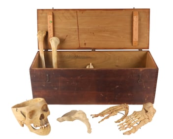 Non-Articulated Human Bones for Medical Use