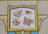 Antique Medical Charts Body Scope 1800's - 9