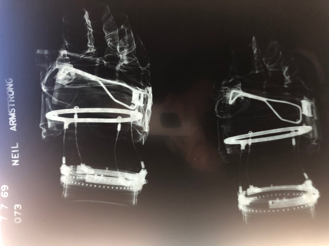 Neil Armstrong- X-Ray of his Apollo 11 Worn Gloves (1 of 1)