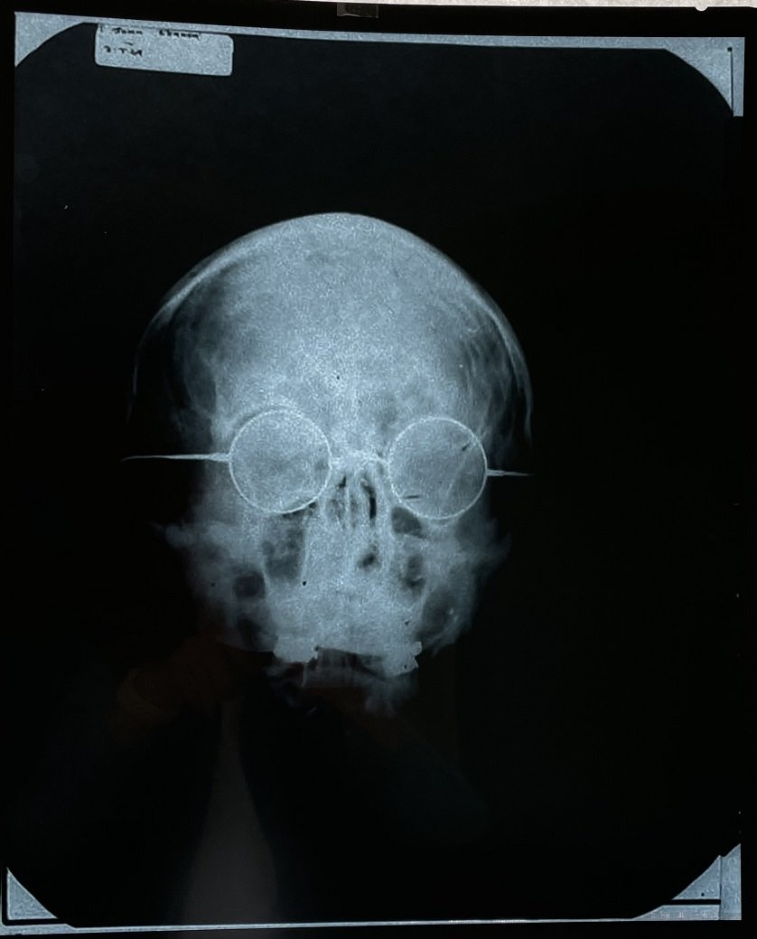 John Lennon-X-Ray 1969 Record "Cold Turkey" (1 of 1)