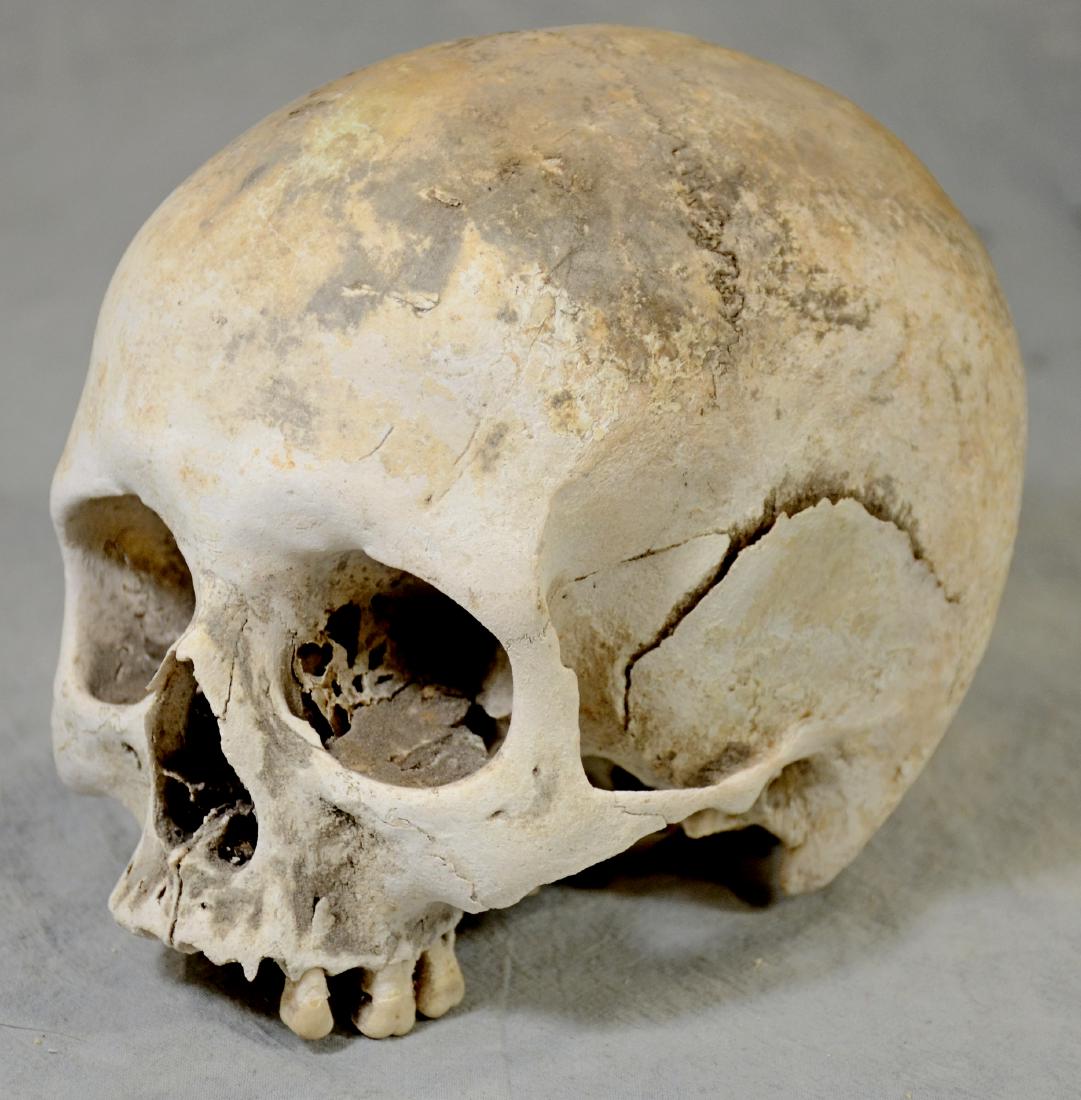 Authentic Human Skull  Medium Size Medical Use sans (1 of 3)
