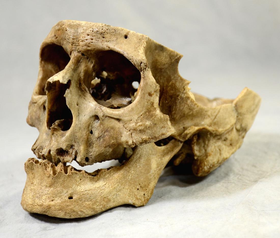 Real Human Skull for Medical Use w/ Lower Jaw sans (1 of 4)