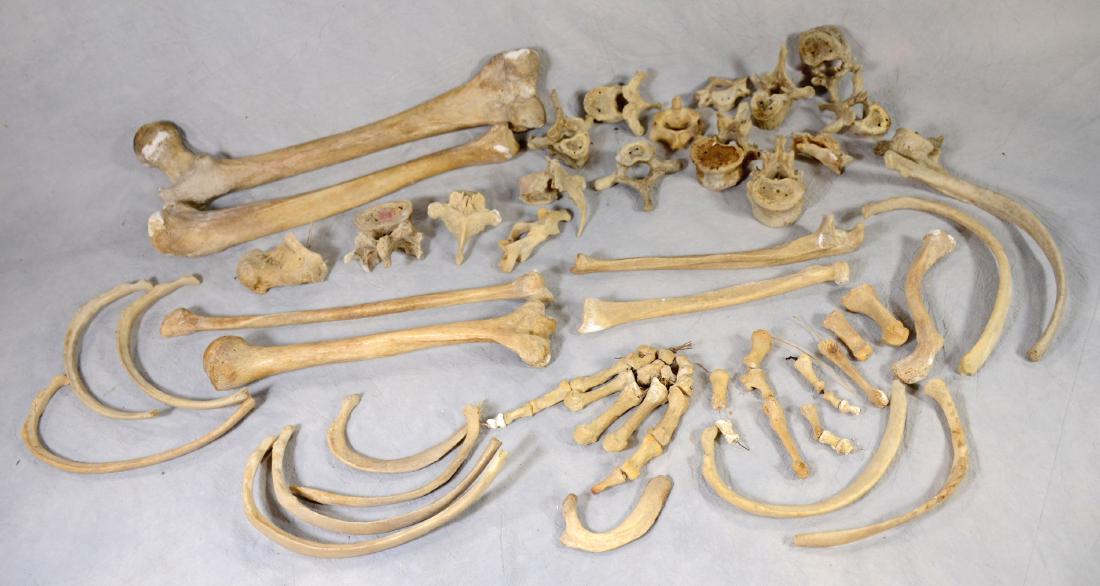 Real Human Bones  Non articulated  For Medical Use / (1 of 1)