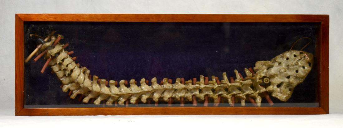 Cased Human Spine & Sacrum Fully Articulated  Medical (1 of 1)