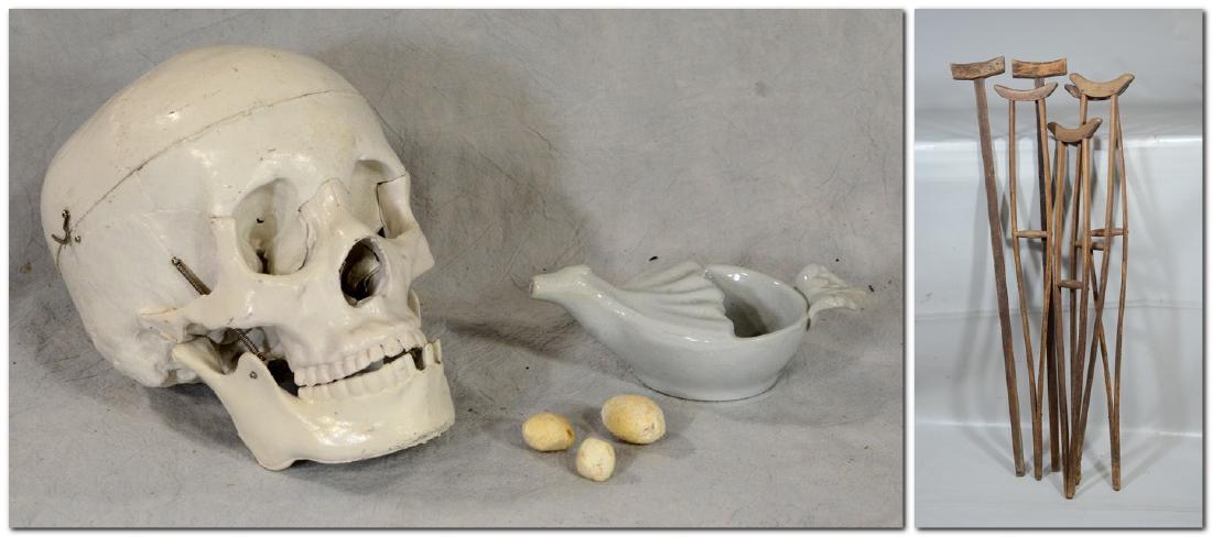 Kidney Gall Stone Lot  3pcs  Odd  HUGE!; Medical (1 of 3)