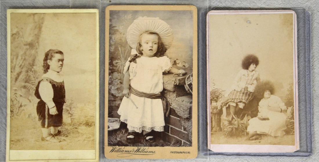 Victorian Side Show Circus Freak CDV Photograph Lot (1 of 2)