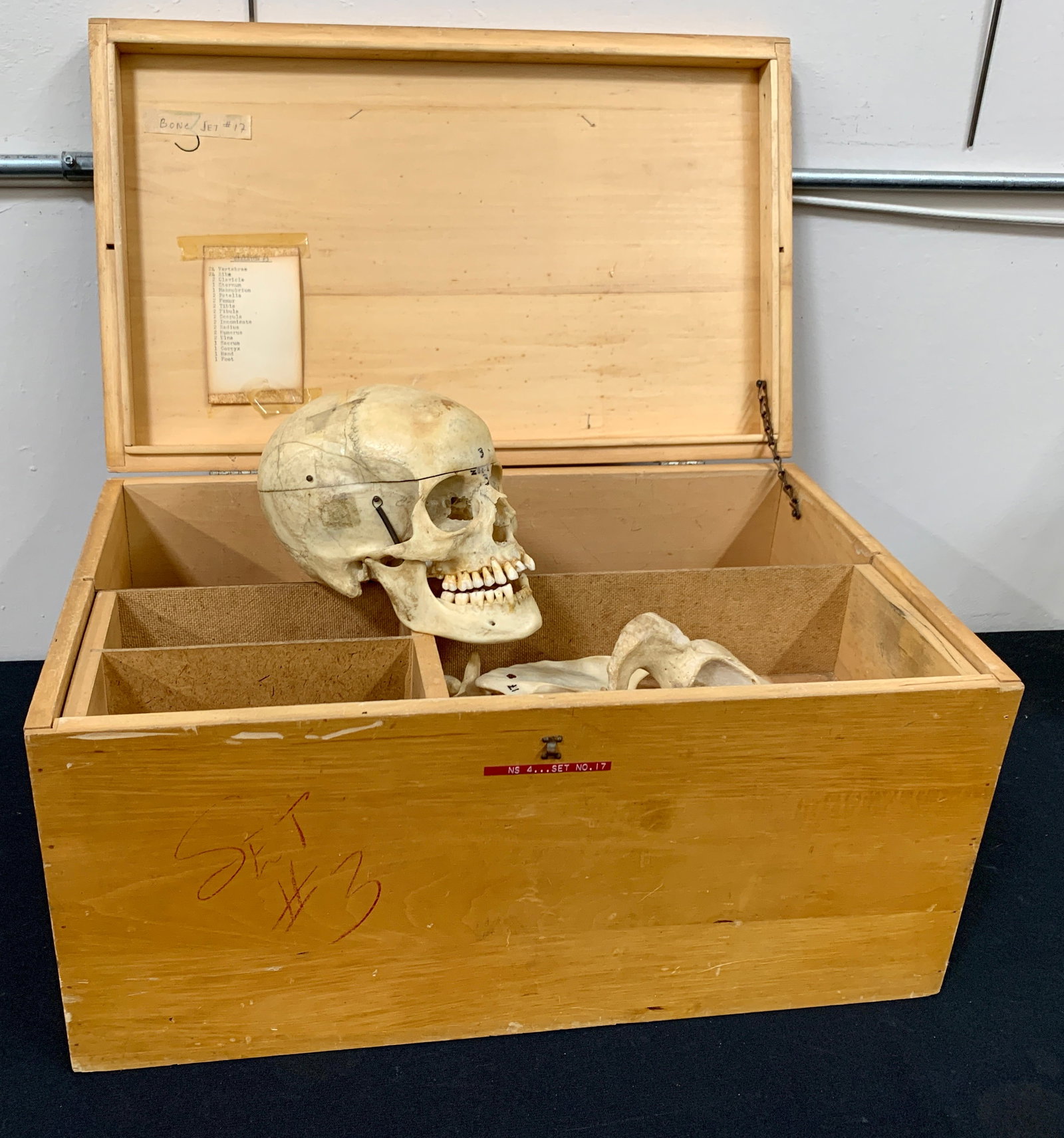 Medical Real Human Skull & Other Bones w/Box: Assembled for medical students is this grouping of real bones in the original wood box to hold them. The box has a label which reads Denoyer-Geppert Co. Also, a brass tag for El Camino College #1755, 