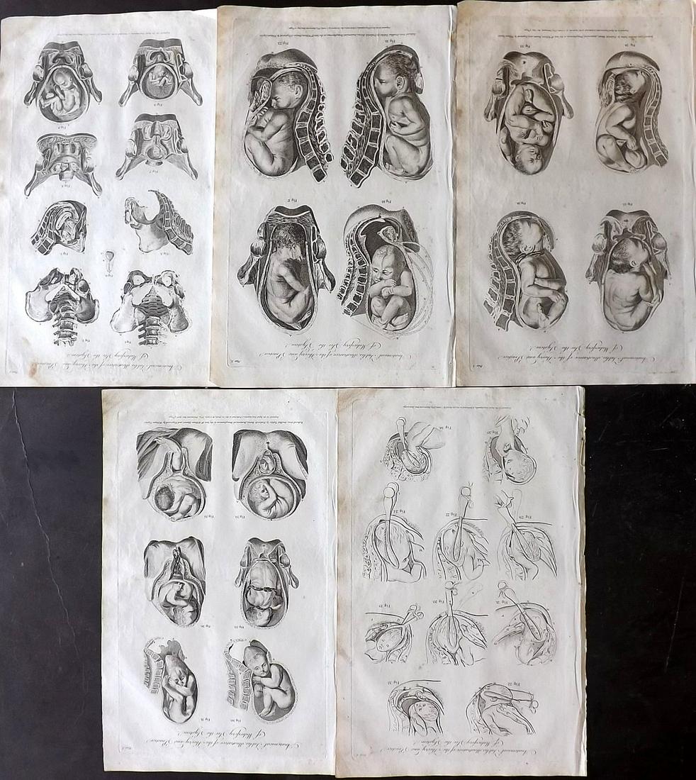 Hall, William 1791 Lot of 5 Folio Midwifery Prints (1 of 2)