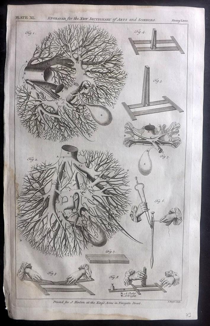 Hinton (Pub) 1756 Folio Anatomy Print. Liver (1 of 2)