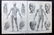 Encyclopaedia Britannica 1878 Lot of 5 Anatomy Prints - 2