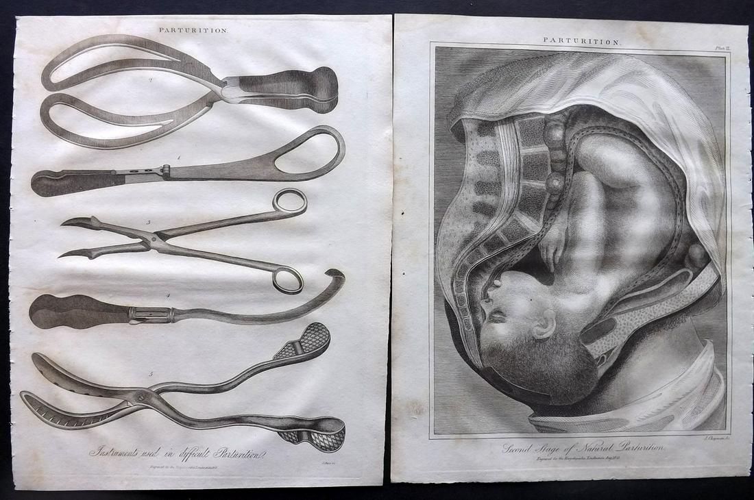 Wilkes, John C1815 Print. Pair of Midwifery Prints: Copper Plate Published 1796-1828 London for "Encyclopaedia Londinensis, or universal dictionary of arts, sciences and literature" by John Wilkes et al. Paper Size: 10.5 x 8.5 inch (27 x 22cm) Minor to