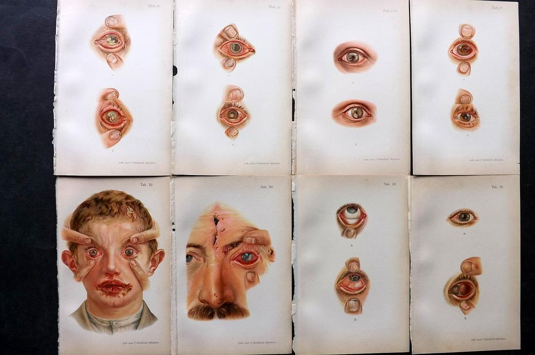Haab, Otto 1901 Lot of 8 Medical Prints. Eye Diseases (1 of 2)