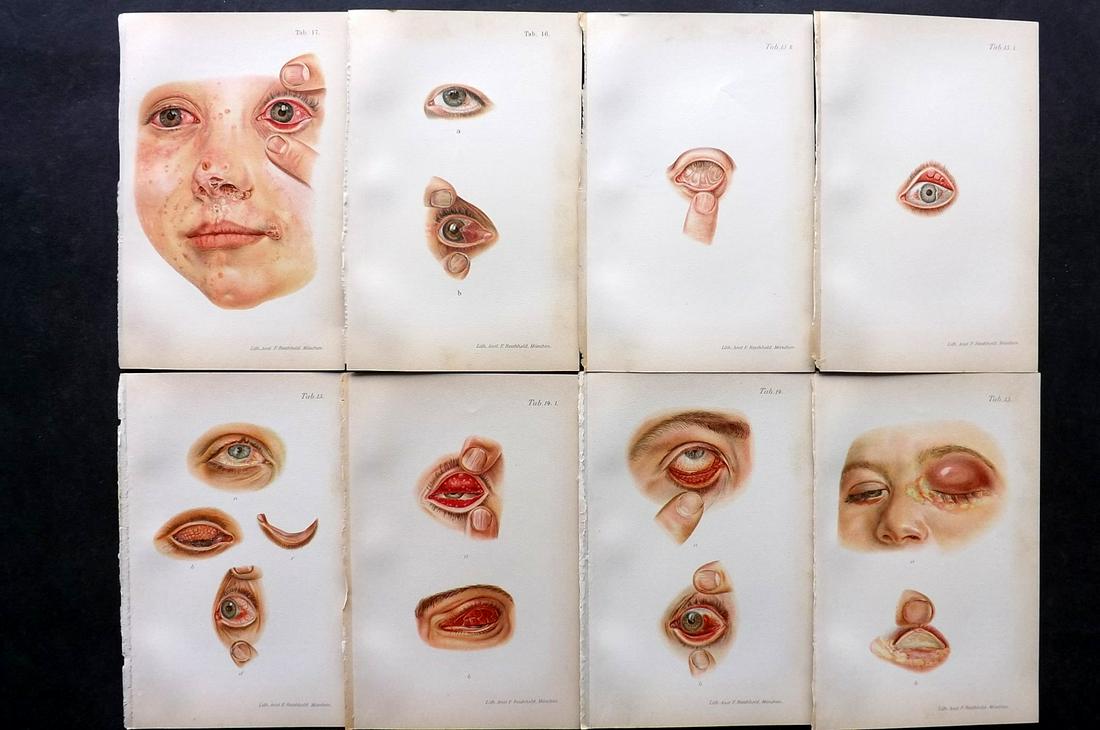 Haab, Otto 1901 Lot of 8 Medical Prints. Eye Diseases (1 of 2)